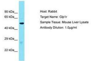 Image no. 1 for anti-Glucagon-Like Peptide 1 Receptor (GLP1R) (AA 101-150) antibody (ABIN6750508) (GLP1R antibody  (AA 101-150))