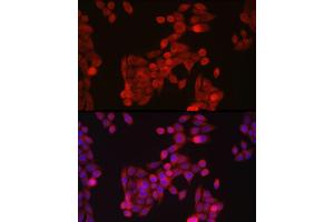 Immunofluorescence analysis of HeLa cells using ZIP14 Rabbit pAb (ABIN6133191, ABIN6147993, ABIN6147994 and ABIN6214658) at dilution of 1:100 (40x lens). (SLC39A14 antibody  (AA 240-340))