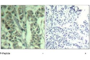 Image no. 2 for anti-Cas-Br-M (Murine) Ecotropic Retroviral Transforming Sequence (CBL) (pTyr700) antibody (ABIN319293) (CBL antibody  (pTyr700))