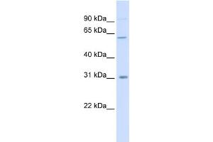 WB Suggested Anti-CHST2 Antibody Titration:  0. (CHST2 antibody  (Middle Region))