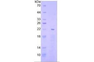 SDS-PAGE (SDS) image for Early Growth Response 1 (EGR1) ELISA Kit (ABIN6730895)