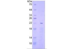 SDS-PAGE of Protein Standard from the Kit  (Highly purified E. (EGR1 ELISA Kit)