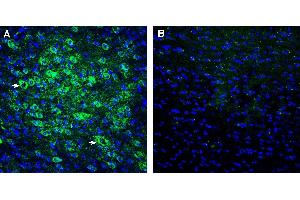 Expression of FSHR in mouse cortex. (FSHR antibody  (Extracellular))
