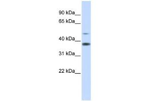 Western Blotting (WB) image for anti-Methylmalonic Aciduria (Cobalamin Deficiency) CblD Type, with Homocystinuria (MMADHC) (Middle Region) antibody (ABIN2786153)