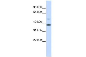 WB Suggested Anti-C2orf25 Antibody Titration: 0.