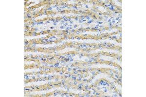 Immunohistochemistry of paraffin-embedded mouse kidney using C4BPB antibody at dilution of 1:100 (40x lens). (C4BPB antibody)