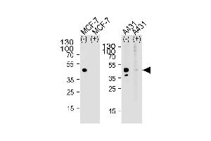 Western blot analysis of lysate from MCF-7, A431 cell line, using CALCR Antibody with(+) or without(-) peptides at 1:1000 at each lane. (MICU1 antibody  (C-Term))