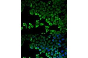 Immunofluorescence analysis of HeLa cells using RIG-I / DDX58 Polyclonal Antibody (DDX58 antibody)