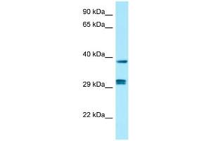 WB Suggested Anti-PPP1CB Antibody Titration: 1. (PPP1CB antibody  (C-Term))