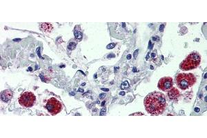 IHC Information:  Lung, Human: Formalin-Fixed, Paraffin-Embedded (FFPE) (CYBB antibody  (C-Term))