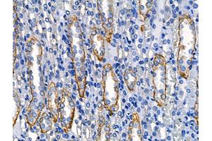 ABIN6262627 and ABIN6268688 at 1/100 staining Rat kidney tissue by IHC-P. (IL-4 antibody  (Internal Region))