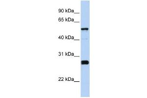 Western Blotting (WB) image for anti-Family with Sequence Similarity 83, Member F (FAM83F) antibody (ABIN2459545) (FAM83F antibody)