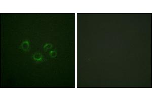 Immunofluorescence analysis of A549 cells, using EPHA2/3/4 (Ab-588/596) antibody. (EPHA2/3/4 antibody)