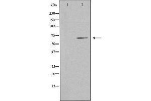 Western blot analysis of extracts from COLO cells, using NR4A3 antibody.