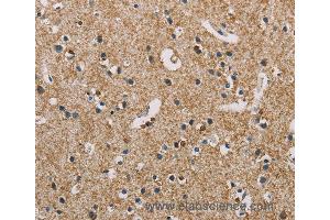 Immunohistochemistry of Human brain  using PIP4K2A Polyclonal Antibody at dilution of 1:50