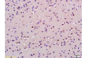 H2AFX antibody  (pSer140)