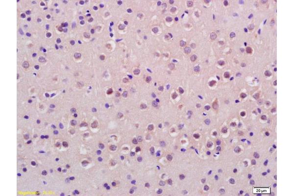 H2AFX antibody  (pSer140)