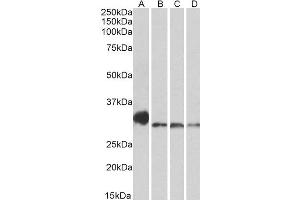 ABIN2564085 (0. (NEK7 antibody  (C-Term))