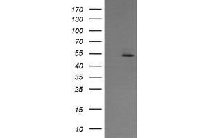 Image no. 3 for anti-ERG, ETS transcription factor (ERG) antibody (ABIN1498080) (ERG antibody)