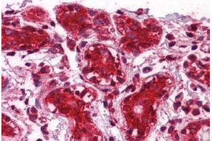 Human Breast: Formalin-Fixed, Paraffin-Embedded (FFPE) (CLIC1 antibody  (AA 1-242))