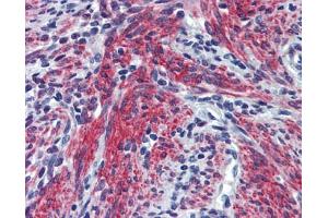 POSTN antibody was used for immunohistochemistry at a concentration of 4-8 ug/ml. (Periostin antibody  (N-Term))