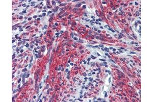 POSTN antibody was used for immunohistochemistry at a concentration of 4-8 ug/ml.
