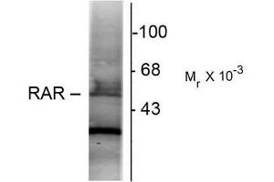 Western Blotting (WB) image for anti-Retinoic Acid Receptor, alpha (RARA) (N-Term) antibody (ABIN371837) (Retinoic Acid Receptor alpha antibody  (N-Term))
