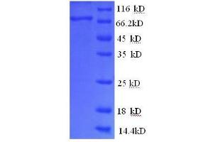 SDS-PAGE (SDS) image for Glucose-6-Phosphate Isomerase (GPI) (AA 2-554), (partial) protein (His tag) (ABIN1047072) (GPI Protein (AA 2-554, partial) (His tag))