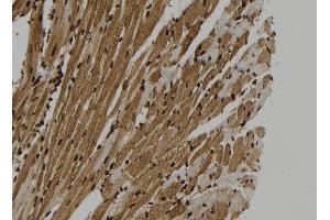 ABIN6265365 and ABIN6273325 at 1/100 staining Mouse heart tissue by IHC-P. (SUGT1 antibody  (C-Term))