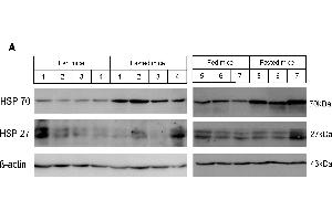 Western Blotting (WB) image for anti-Heat Shock Protein 70 (HSP70) antibody (ABIN361707)