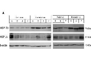 Western blot analysis of heat shock protein expression in fasted mouse livers. (HSP70 antibody)