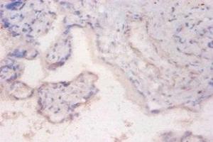 Immunohistochemistry of paraffin-embedded human placenta tissue using ABIN7168200 at dilution of 1:100 (RPS6KB2 antibody  (AA 1-210))