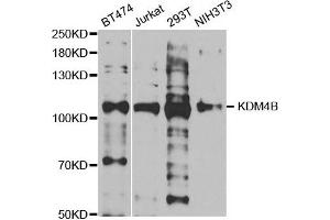 Western blot analysis of extracts of various cell lines, using KDM4B antibody. (KDM4B antibody)