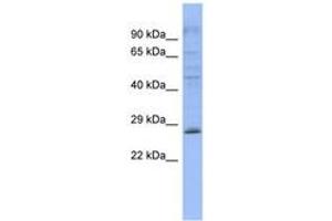 Image no. 1 for anti-Pleckstrin Homology Domain Containing, Family B (Evectins) Member 2 (PLEKHB2) (AA 143-192) antibody (ABIN6743268)