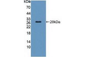 Figure. (TSH receptor antibody  (AA 28-245))
