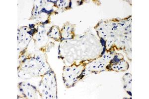 Anti-CYP11A1 antibody, IHC(F): Human Placenta Tissue (CYP11A1 antibody  (C-Term))