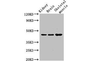 Caspase 4 Antikörper  (AA 82-226)