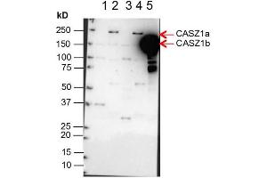 Western Blotting (WB) image for anti-Castor Zinc Finger 1 (CASZ1) (Internal Region) antibody (ABIN964598)