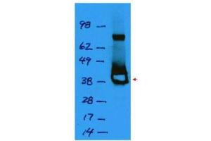 Western blot using  affinity purified anti-Lac I antibody shows detection of a 38 kDa band corresponding to recombinant Lac I (arrowhead). (LacI antibody)