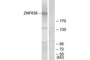 Western Blotting (WB) image for anti-Zinc Finger Protein 638 (ZNF638) (AA 1271-1320) antibody (ABIN2889597) (ZNF638 antibody  (AA 1271-1320))