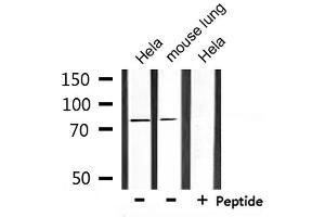 Western blot analysis of extracts from Hela and mouse lung, using SLC9A7 Antibody. (NHE7 antibody  (Internal Region))