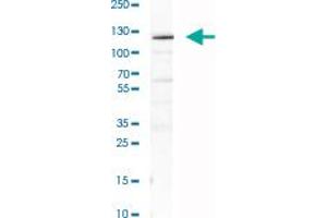 Western Blot analysis of RH-30 cell lysate with NNT polyclonal antibody . (NNT antibody)