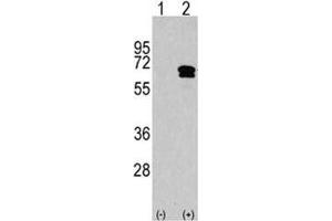 Western blot analysis of CAMKK2 antibody and 293 cell lysate either nontransfected (Lane 1) or transiently transfected with the CAMKK2 gene (2). (CAMKK2 antibody  (AA 483-512))