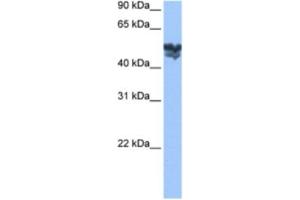 Western Blotting (WB) image for anti-WAS Protein Family, Member 3 (WASF3) antibody (ABIN2463503) (WASF3 antibody)