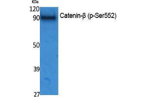 Western Blotting (WB) image for anti-Catenin, beta (CATNB) (pSer552) antibody (ABIN3173575) (beta Catenin antibody  (pSer552))