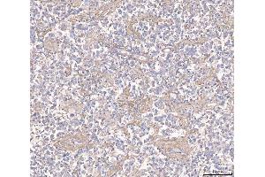 IHC analysis of ANGPT2 using anti-ANGPT2 antibody (ABIN3043725). (Angiopoietin 2 antibody  (AA 19-348))