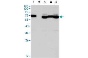 Western blot analysis using TCF3 monoclonal antobody, clone 6B8  against A-549 (1), A-431 (2), HeLa (3), PANC-1 (4) and PC-3 (5) cell lysate.