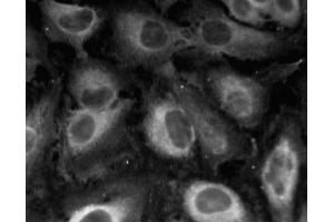 Immunofluorescent staining of HeLa (ATCC CCL-2) cells. (Caveolin-1 antibody  (AA 1-97))
