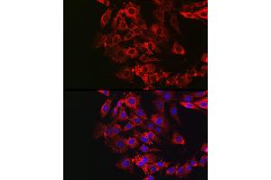 Immunofluorescence analysis of NIH/3T3 cells using GSDME antibody (ABIN6127757, ABIN6139554, ABIN6139555 and ABIN6223304) at dilution of 1:50. (Non-Syndromic Hearing Impairment Protein 5 (GSDME) (AA 1-260) antibody)