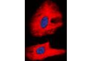 Immunofluorescence (IF) image for anti-Ret Proto-Oncogene (RET) (C-Term), (pTyr1062) antibody (ABIN7301218)